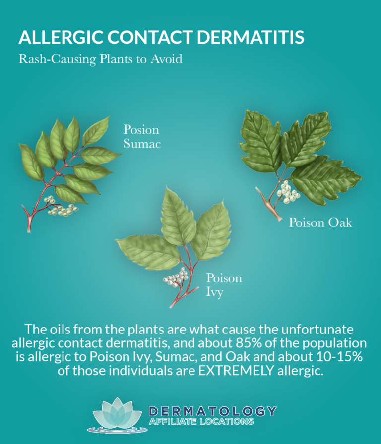 Allergic Contact Dermatitis What To Know Sjh Derm